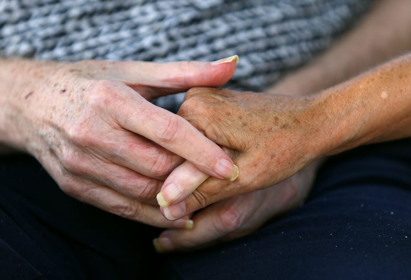 Alzheimer's disease